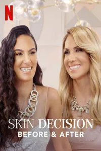 Skin Decision: Before and After izle